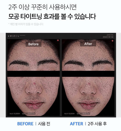 [Medicube] Zero Pore Pad 2.0 – Smooth & Refreshing Daily Toner Pads – 70 Pads