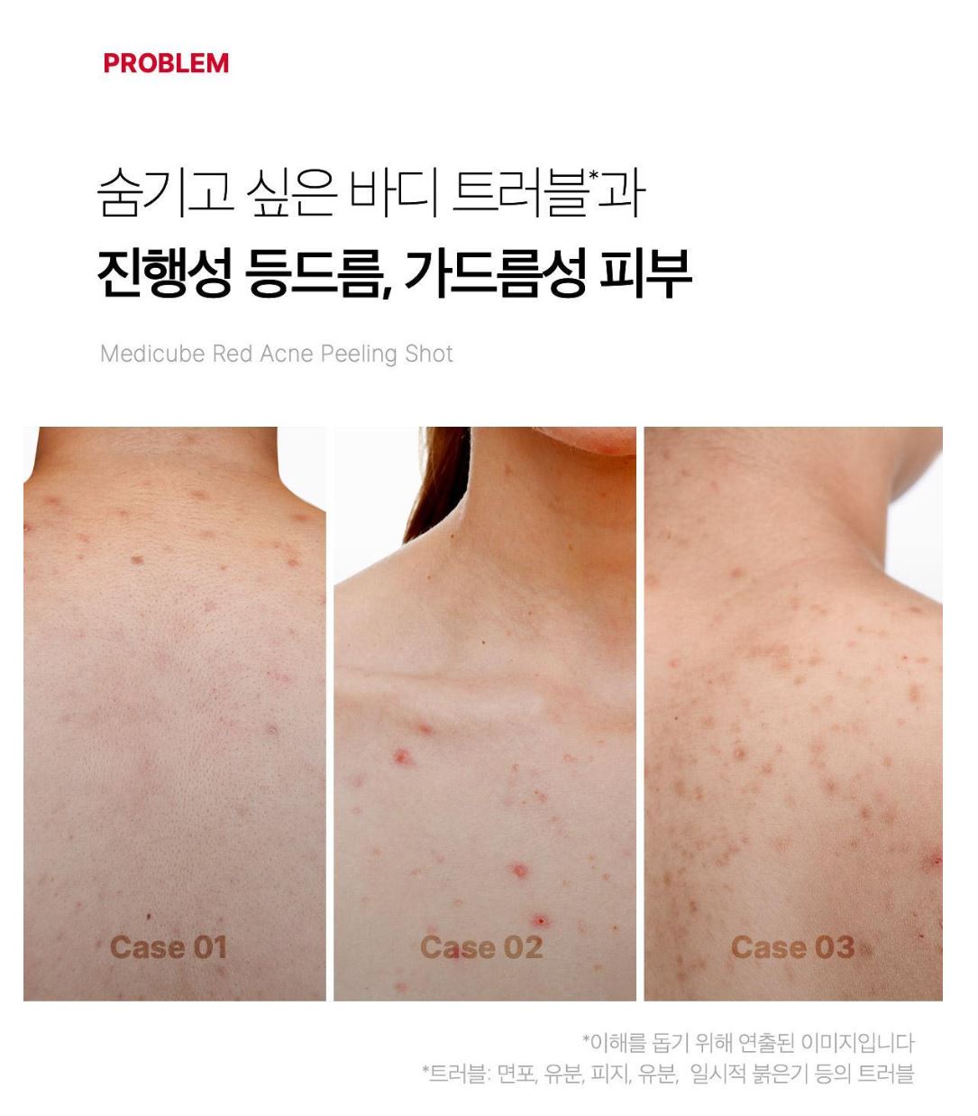 [Medicube] Red Body Peeling Mist for Smooth Skin – 110g by Olive Young