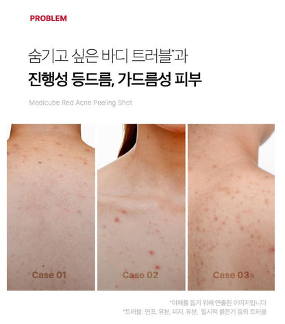 [Medicube] Red Body Peeling Mist for Smooth Skin – 110g by Olive Young