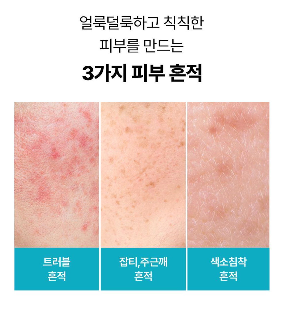 [Mediheal] Madecassoside Blemish Repair Serum | Calming Formula | 40ml + 40ml + 10ml | GlowLab