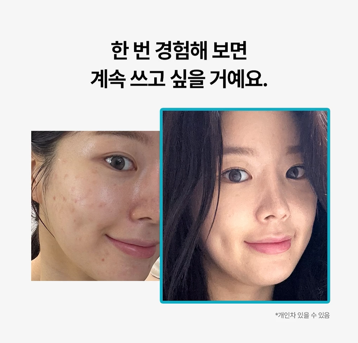 [Mediheal] Madecassoside Blemish Repair Serum | Calming Formula | 40ml + 40ml + 10ml | GlowLab