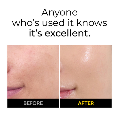 [MEDIHEAL] Vitamin C Brightening Serum with Niacinamide | Tone · Texture · Glow Care | 40ml x2 Double Set | GlowLab