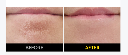 [MEDIHEAL] Vitamin C Brightening Serum with Niacinamide | Tone · Texture · Glow Care | 40ml x2 Double Set | GlowLab