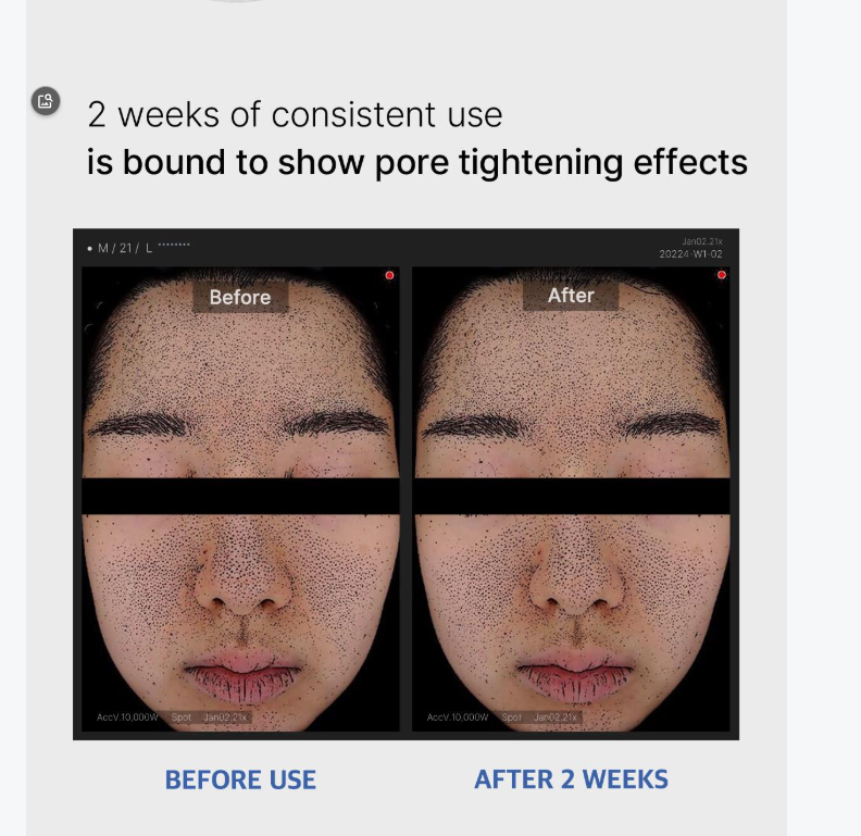 [Medicube] Zero Pore Pad 2.0 Refill Set | Daily Skin Care & Sebum Control | 70 Pads