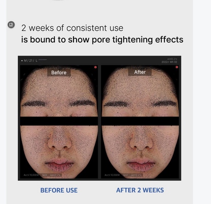 [Medicube] Zero Pore Pad 2.0 Refill Set | Daily Skin Care & Sebum Control | 70 Pads