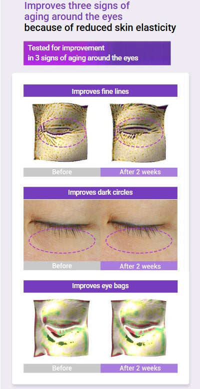 [BIOHEAL BOH] Probioderm 3D Lifting Eye & Wrinkle Cream – Smooth Firming Texture for Delicate Eye Area | 25mL Double Pack