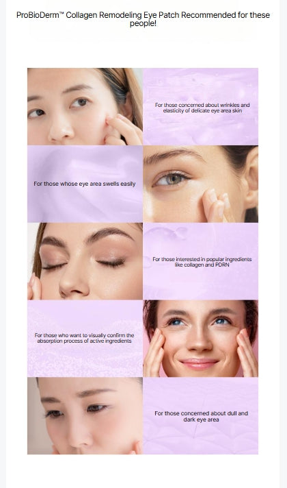[BIOHEAL BOH] Probioderm™ Collagen Remodeling Eye Patch – Refreshing Hydrogel Care | 60 Patches