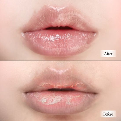 [XOUL] Ever Moist Volume Lip Balm | 8g | Premium Moisturizing & Nourishing Lip Balm | GlowLab