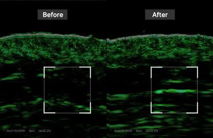 [medicube] PDRN Pink Collagen Gel Mask + Fresh Dewy Finish 4 Sheets by oliveYoung