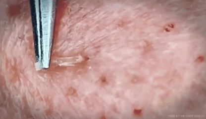 [Medicube] Zero Pore Pad 2.0 Refill Set | Daily Skin Care & Sebum Control | 70 Pads