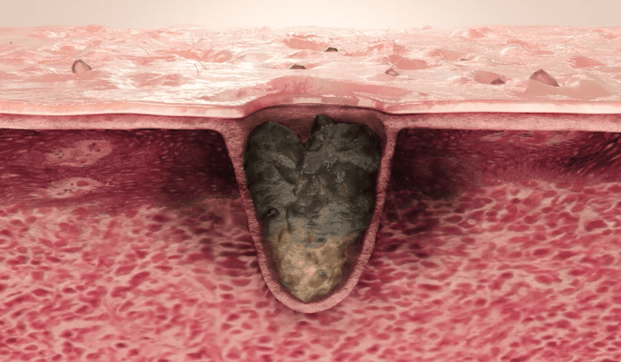 [Medicube] Zero Pore Pad 2.0 Refill Set | Daily Skin Care & Sebum Control | 70 Pads