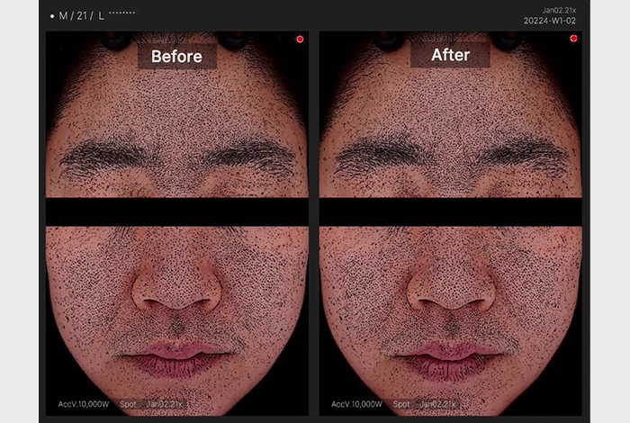 [Medicube] Zero Pore Pad 2.0 Refill Set | Daily Skin Care & Sebum Control | 70 Pads